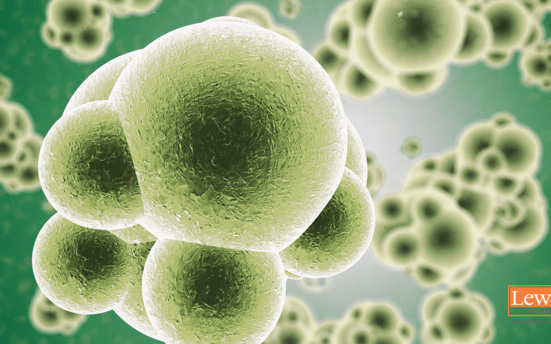 How Long Does it Take to Die from Sepsis?